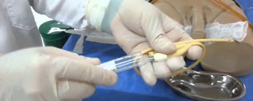 Cateterismo vesical